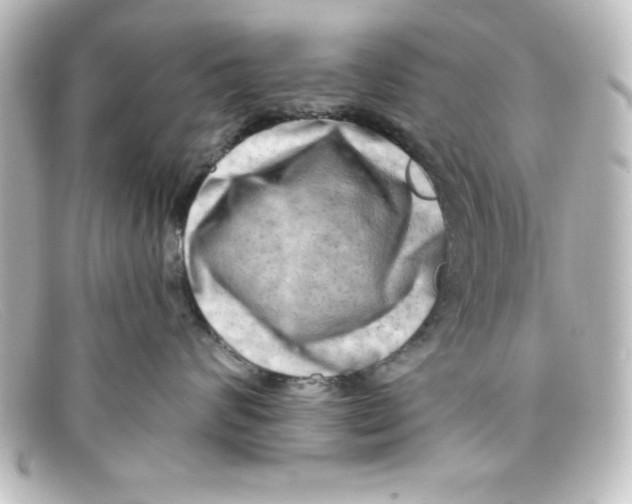 X0000098130624200805081000