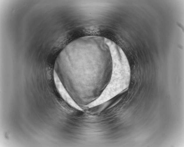 X0000098130658200805080959