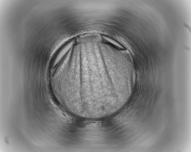 X0000098130676200805080959
