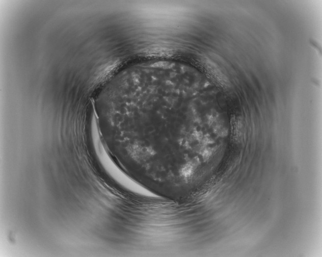 X0000098130692200805080959
