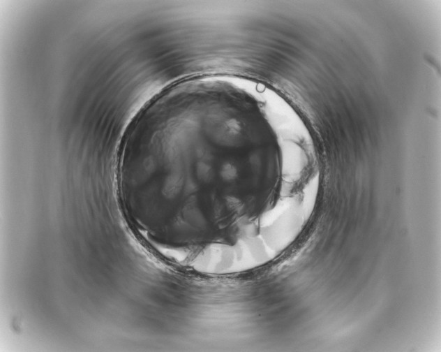 X0000098130941200805080955