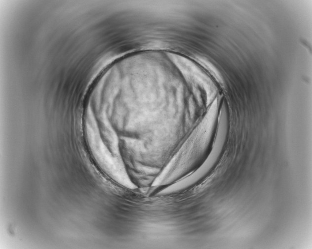 X0000098131000200805080954