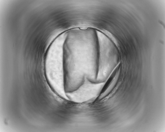X0000098131006200805080954