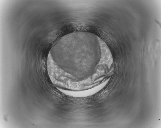 X0000098131010200805080954