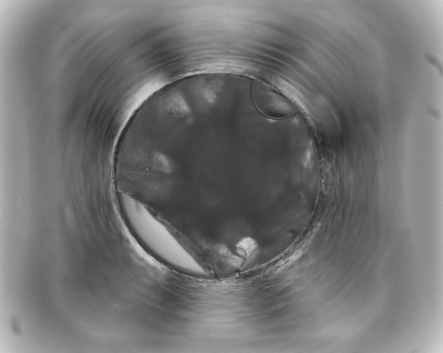 X0000098131087200805080953