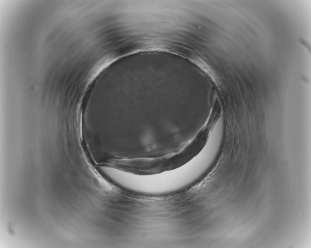 X0000098131127200805080953