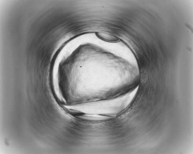 X0000098131139200805080953