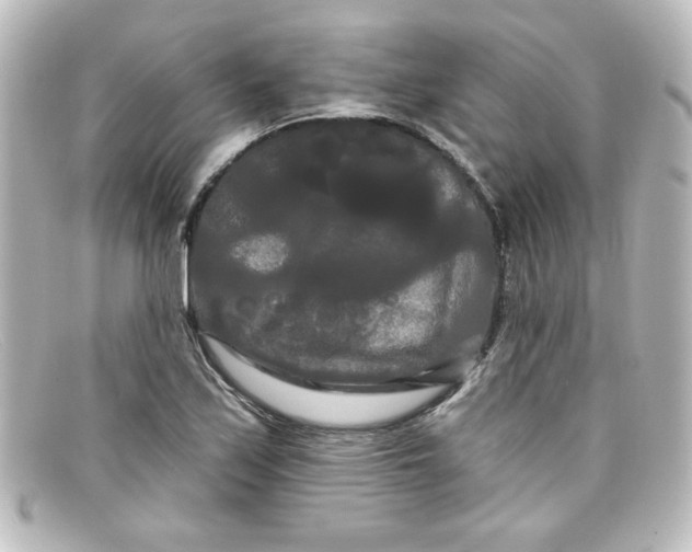 X0000098131171200805080952