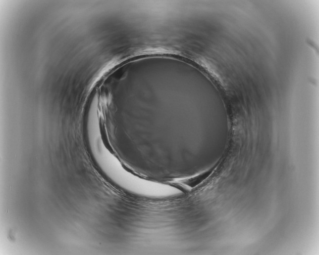 X0000098131173200805080952