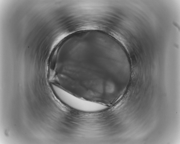 X0000098131179200805080952