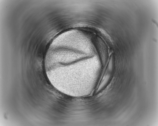 X0000098131217200805080951