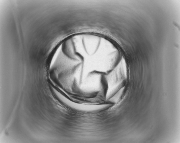 X0000098131501200805080947