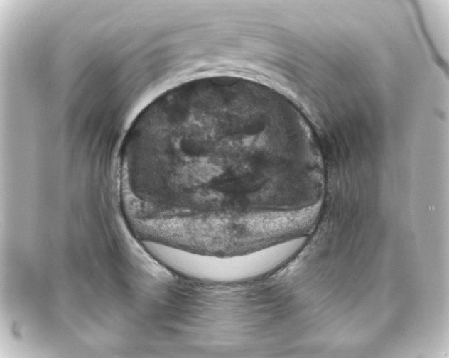 X0000098131522200805080947
