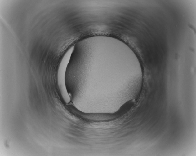 X0000098130017200805151127