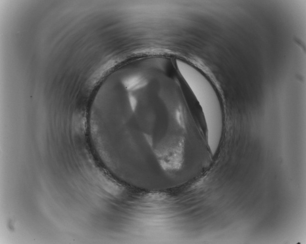 X0000098130063200805151125