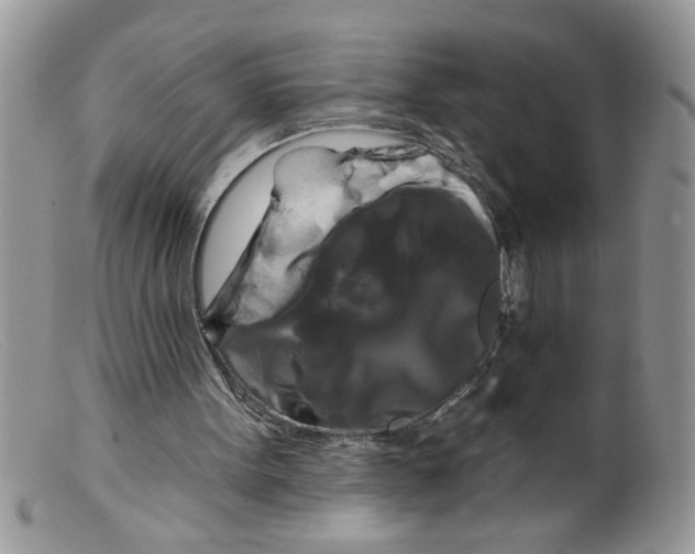 X0000098130099200805151125