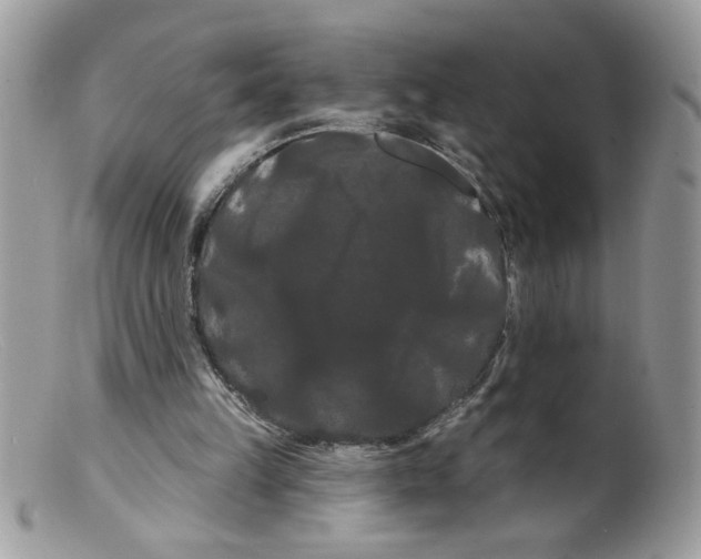 X0000098130149200805151124