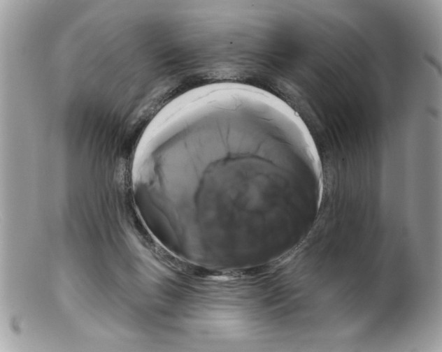 X0000098130167200805151124