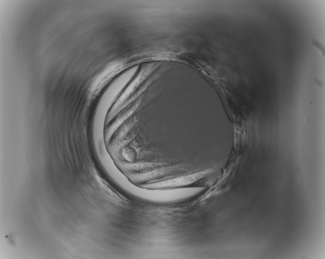 X0000098130197200805151124