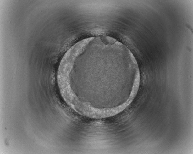 X0000098130259200805151122