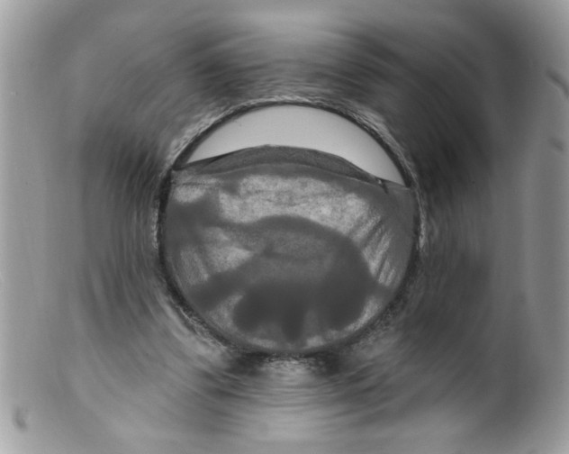 X0000098130299200805151122