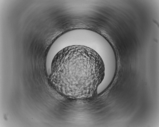 X0000098130305200805151122