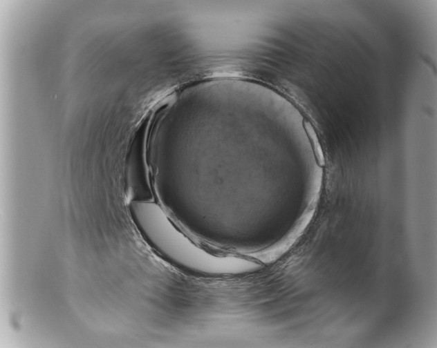 X0000098130385200805151121