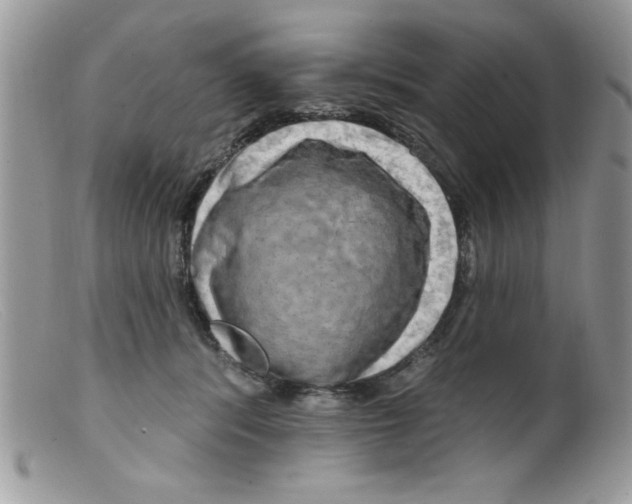 X0000098130416200805151120