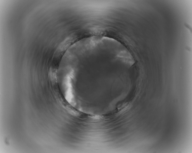 X0000098130432200805151120