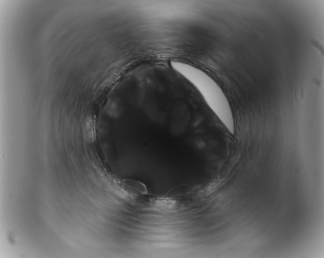 X0000098130471200805151120