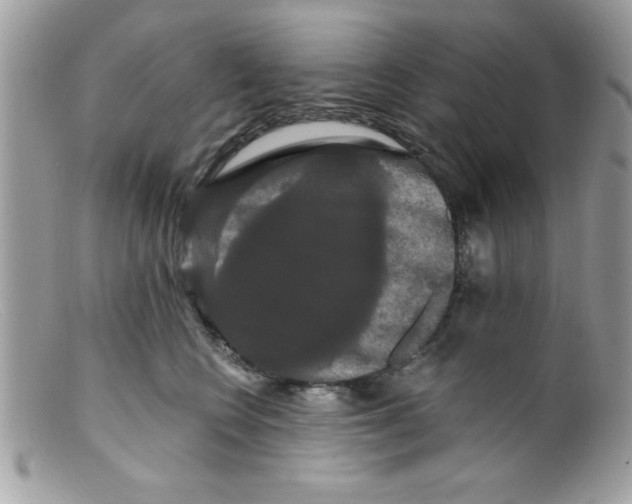X0000098130566200805151118