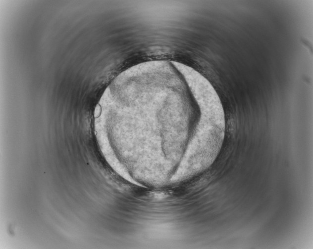 X0000098130662200805151117