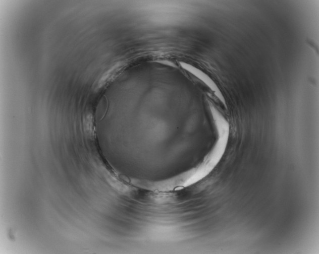 X0000098130670200805151117