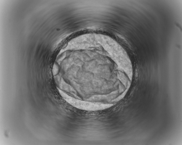 X0000098130776200805151115