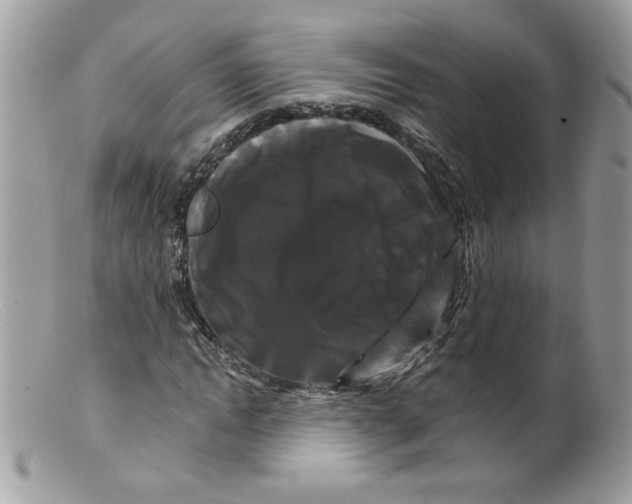 X0000098130822200805151113