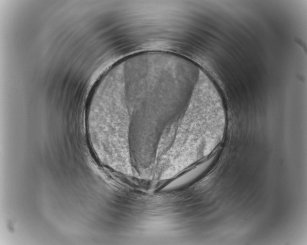 X0000098130939200805151112