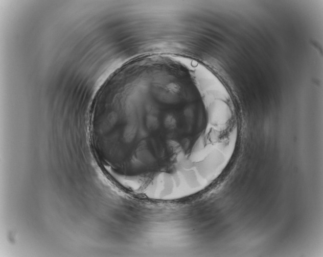 X0000098130941200805151112