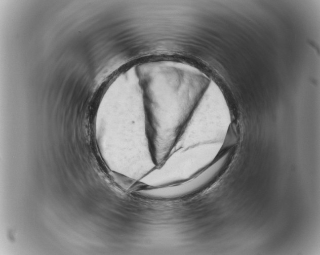 X0000098131018200805151110