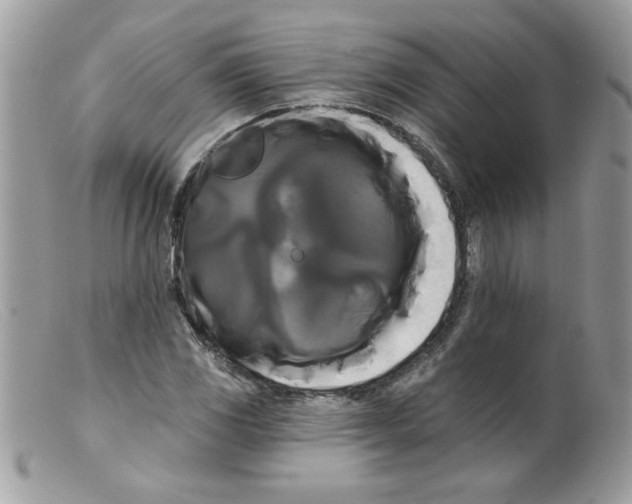 X0000098131117200805151109
