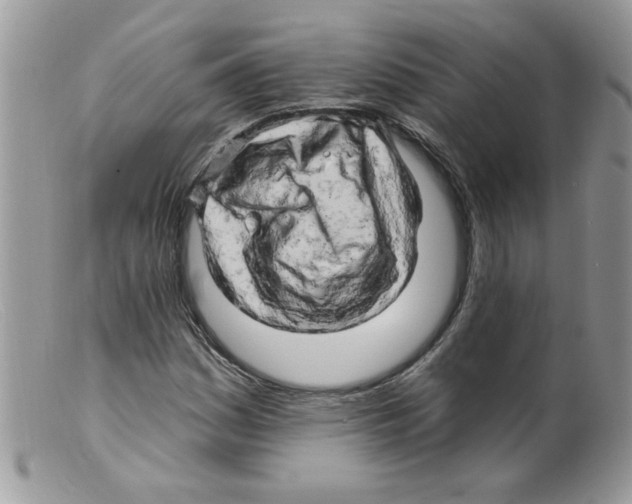 X0000098131161200805151108