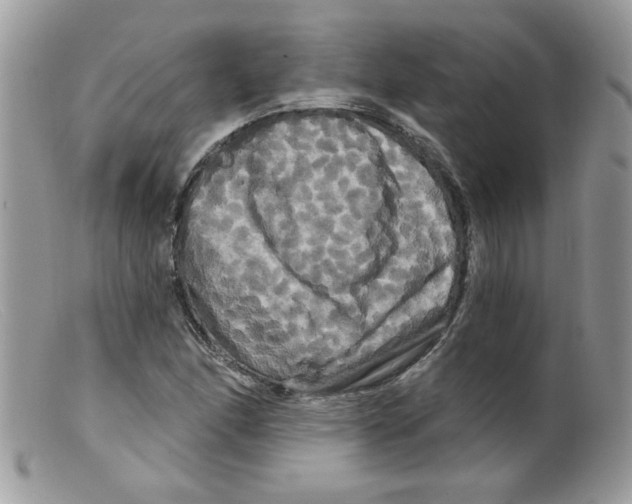 X0000098131166200805151108