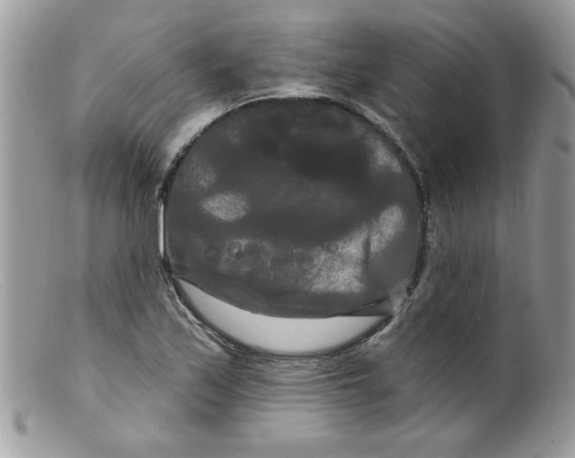 X0000098131171200805151108