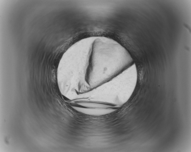X0000098131204200805151107