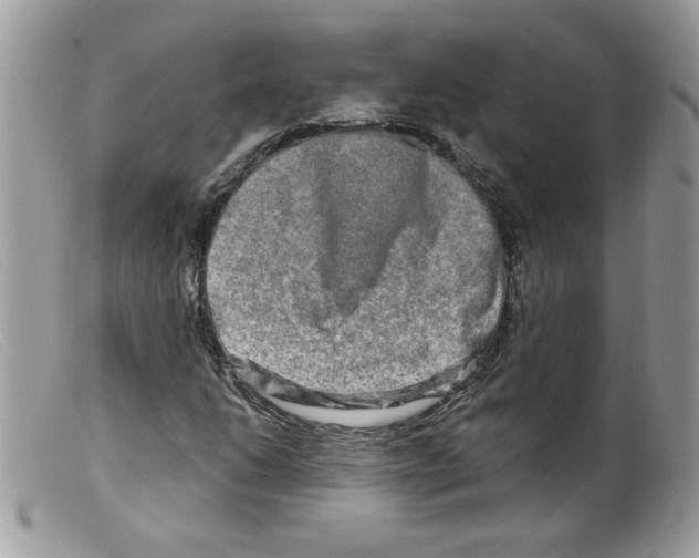 X0000098131206200805151107