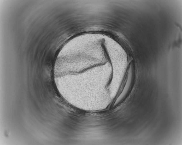 X0000098131217200805151107