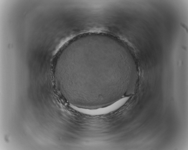 X0000098131256200805151107