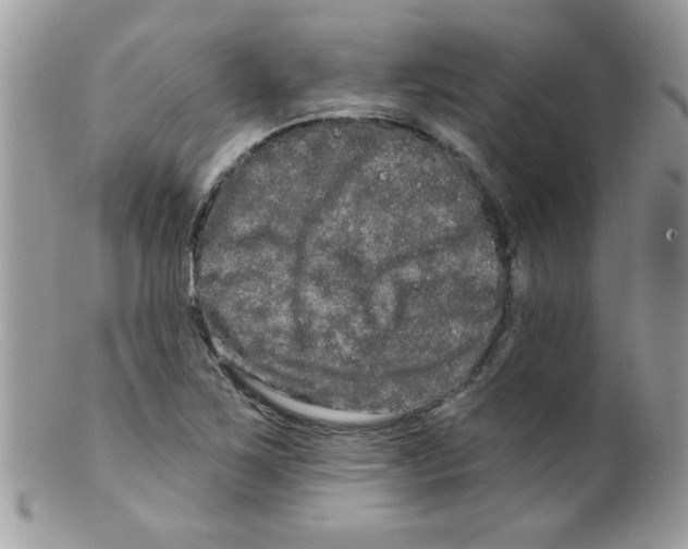 X0000098131267200805151107