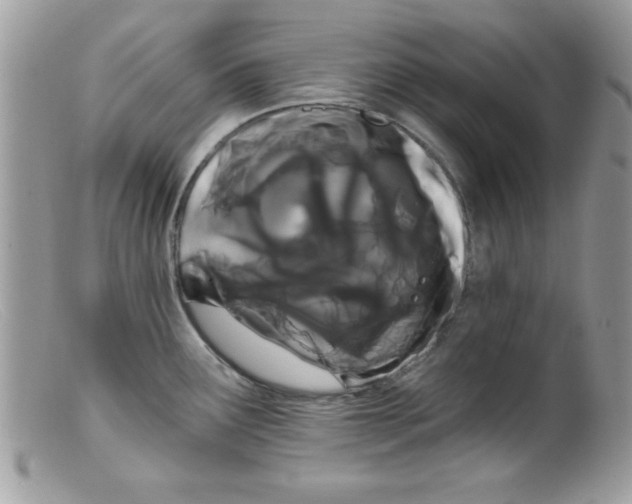 X0000098131291200805151106