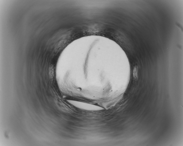 X0000098131299200805151106