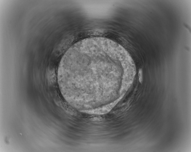 X0000098131395200805151104